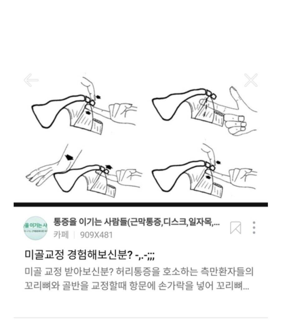 항문에 직접손을 넣어 척추교정하는 미골교정.jpg57